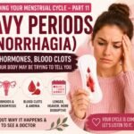 Medical-style thumbnail for an article about heavy periods and menorrhagia, featuring a menstrual calendar, female reproductive system illustration, menstrual blood drops, and educational text about causes of excessive menstrual bleeding and hormonal imbalan