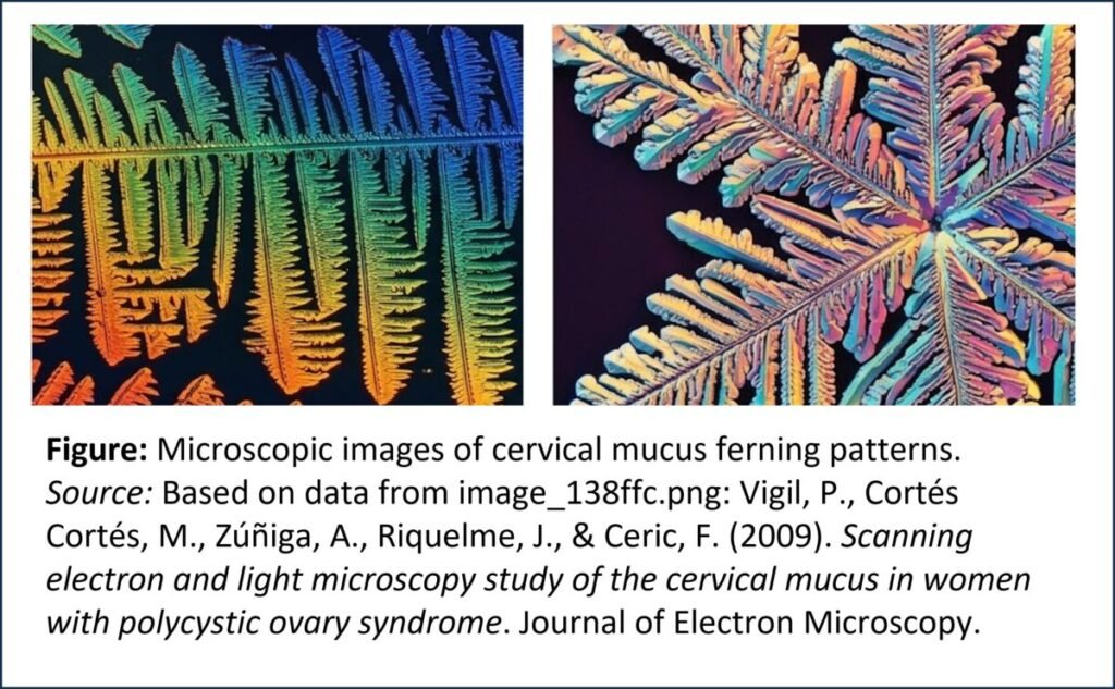 Microscopic images of cervical mucus ferning patterns. Source: Based on data from image_138ffc.png: Vigil, P., Cortés Cortés, M., Zúñiga, A., Riquelme, J., & Ceric, F. (2009). Scanning electron and light microscopy study of the cervical mucus in women with polycystic ovary syndrome. Journal of Electron Microscopy.